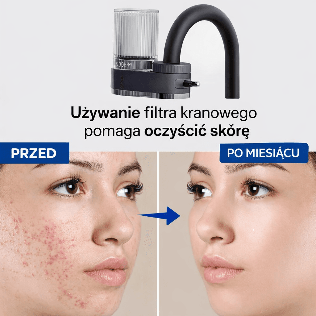 Buyzen - Filtr nakranowy